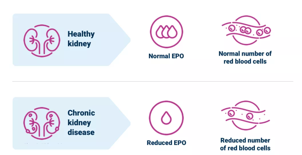 Chart of a healthy kidney versus a ckd kidney