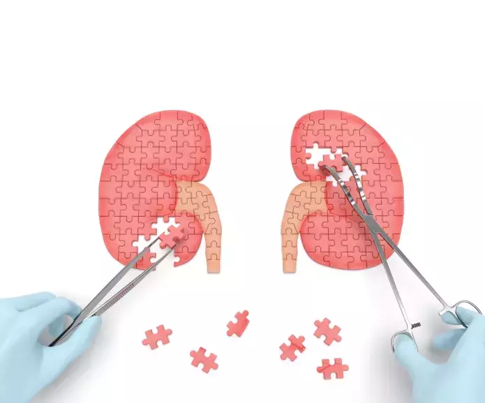 puzzlie kidneys shutterstock 293632781 1