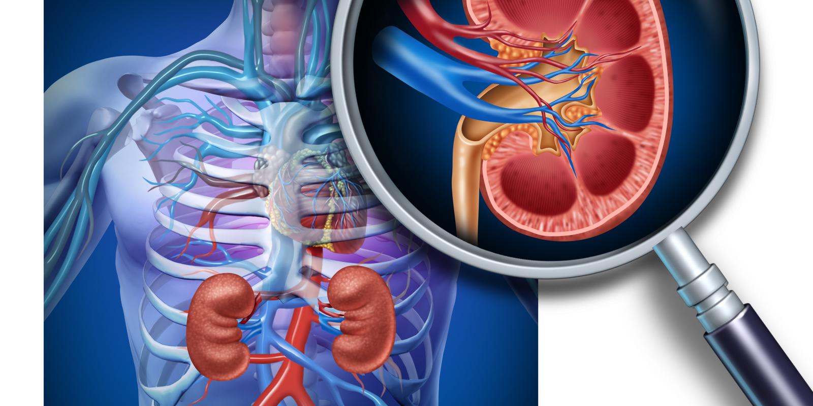 Enfermedad Renal Crónica (ERC) En Etapa 2